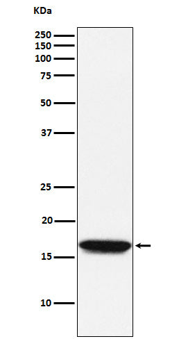Anti-NM23A Monoclonal Antibody Boster Bio