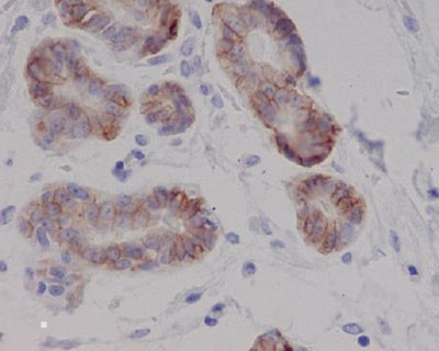 Anti-c-Kit Rabbit Monoclonal Antibody Boster Bio