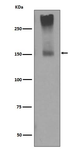 Anti-GRM5/Mglur5 Rabbit Monoclonal Antibody Boster Bio