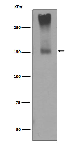 Anti-GRM5/Mglur5 Rabbit Monoclonal Antibody Boster Bio