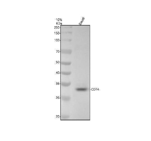 Anti-CD74 Rabbit Monoclonal Antibody Boster Bio