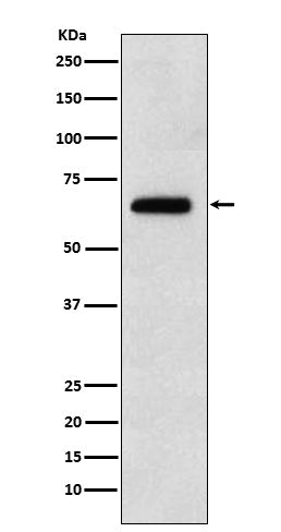 Anti-EBF1 Rabbit Monoclonal Antibody Boster Bio