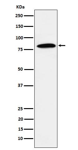 Anti-DBF4 Rabbit Monoclonal Antibody Boster Bio