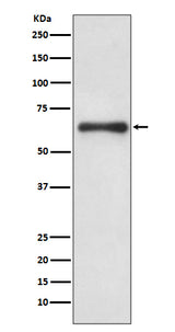 Anti-Cdc6 Rabbit Monoclonal Antibody Boster Bio