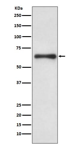 Anti-Cdc6 Rabbit Monoclonal Antibody Boster Bio