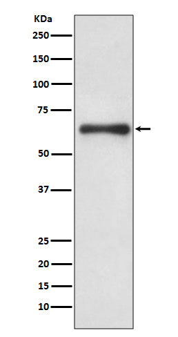 Anti-Cdc6 Rabbit Monoclonal Antibody Boster Bio