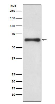 Anti-Cdc6 Rabbit Monoclonal Antibody Boster Bio