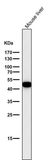 Anti-Cytokeratin 18 KRT18 Rabbit Monoclonal Antibody Boster Bio