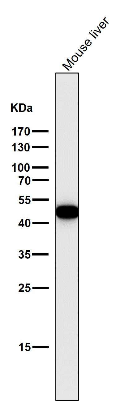 Anti-Cytokeratin 18 KRT18 Rabbit Monoclonal Antibody Boster Bio