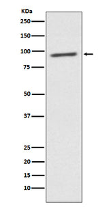 Anti-STAT2 Rabbit Monoclonal Antibody Boster Bio
