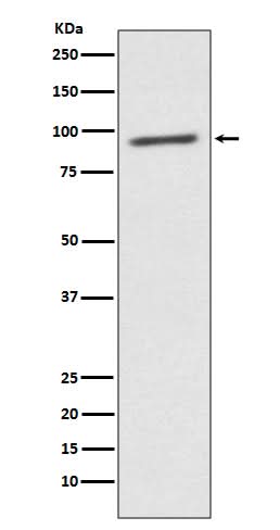 Anti-STAT2 Rabbit Monoclonal Antibody Boster Bio