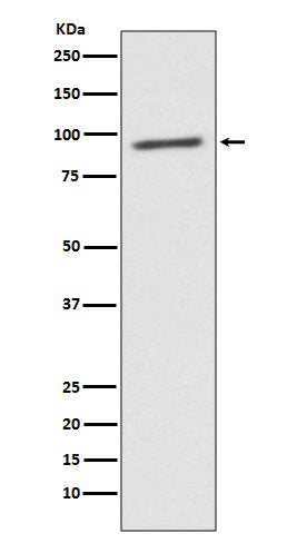 Anti-STAT2 Rabbit Monoclonal Antibody Boster Bio