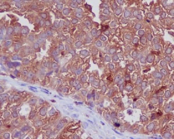 Anti-Cathepsin D CTSD Rabbit Monoclonal Antibody Boster Bio