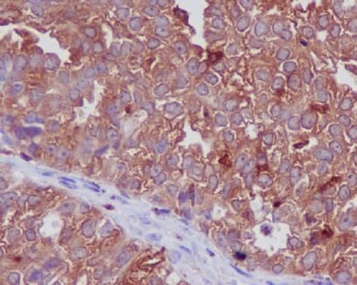 Anti-Cathepsin D CTSD Rabbit Monoclonal Antibody Boster Bio