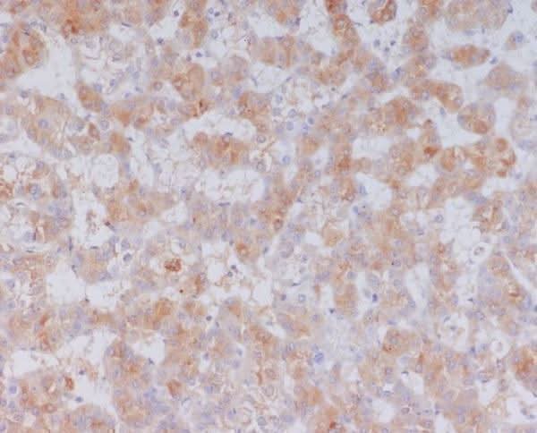 Anti-Serum Amyloid A SAA1 Rabbit Monoclonal Antibody Boster Bio