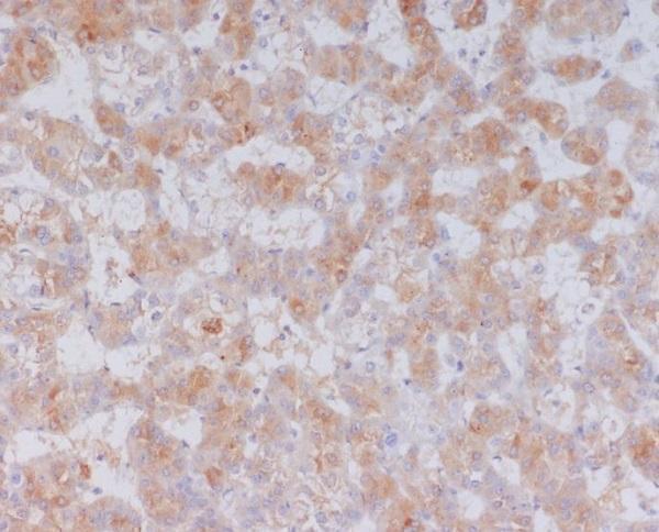 Anti-Serum Amyloid A SAA1 Rabbit Monoclonal Antibody Boster Bio