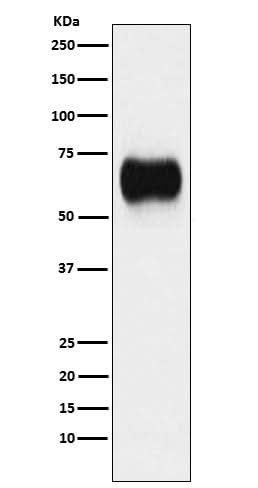 Anti-MICA Rabbit Monoclonal Antibody Boster Bio