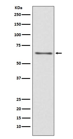 Anti-CDC45/Cdc45L Rabbit Monoclonal Antibody Boster Bio