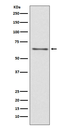Anti-CDC45/Cdc45L Rabbit Monoclonal Antibody Boster Bio