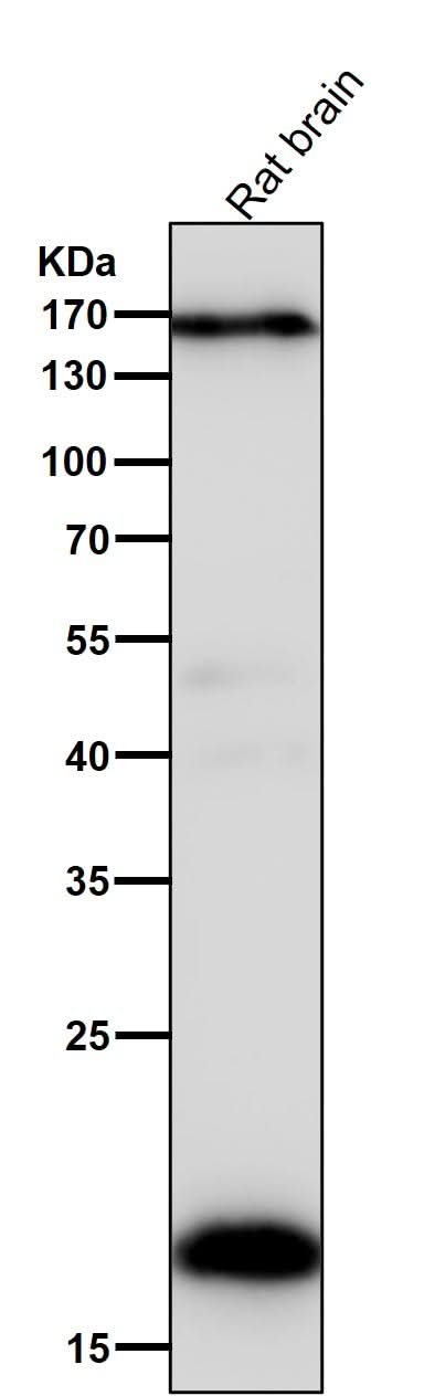 Anti-Pleiotrophin Rabbit Monoclonal Antibody Boster Bio