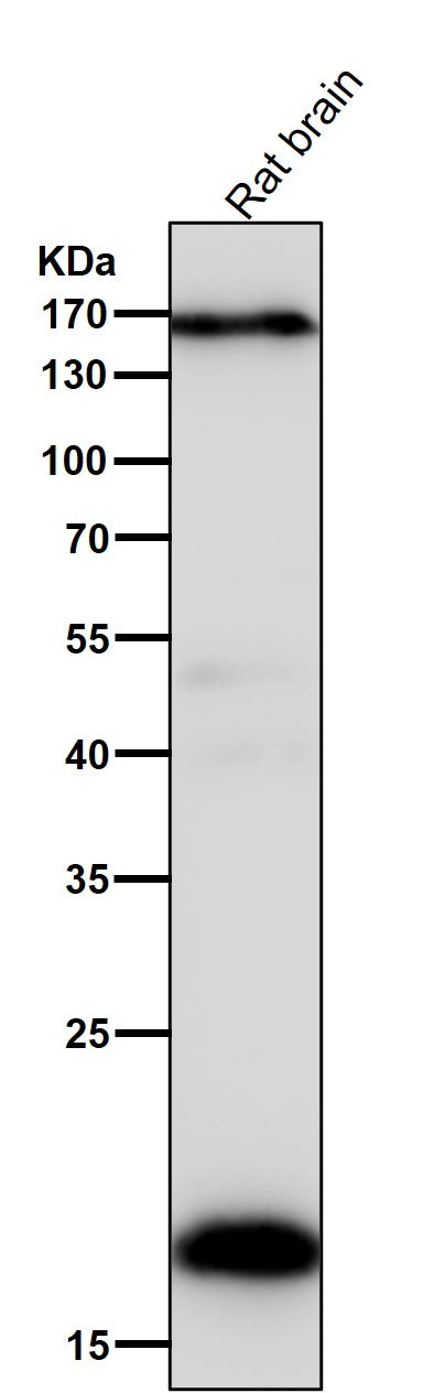 Anti-Pleiotrophin Rabbit Monoclonal Antibody Boster Bio
