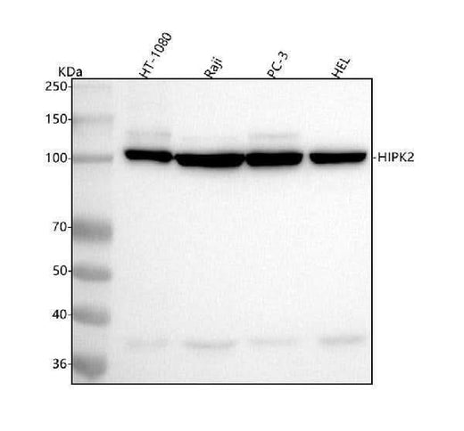 Anti-HIPK2 Rabbit Monoclonal Antibody Boster Bio