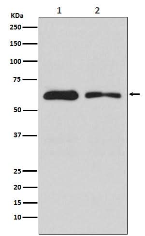 Anti-DOPA Decarboxylase Rabbit Monoclonal Antibody Boster Bio