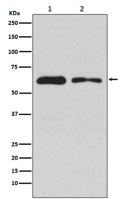 Anti-DOPA Decarboxylase Rabbit Monoclonal Antibody Boster Bio