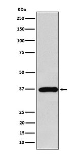 Anti-FBP1 Rabbit Monoclonal Antibody Boster Bio