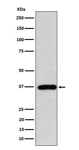 Anti-FBP1 Rabbit Monoclonal Antibody Boster Bio