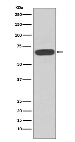 Anti-PKR EIF2AK2 Rabbit Monoclonal Antibody Boster Bio
