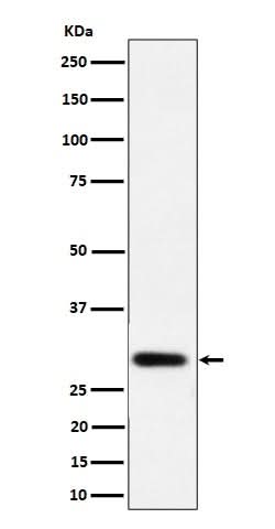 Anti-NAT1 Rabbit Monoclonal Antibody Boster Bio