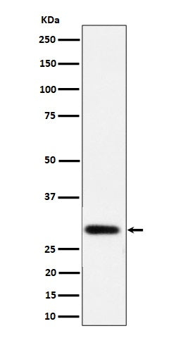 Anti-NAT1 Rabbit Monoclonal Antibody Boster Bio