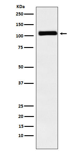 Anti-MIB1 / DIP1 Rabbit Monoclonal Antibody Boster Bio
