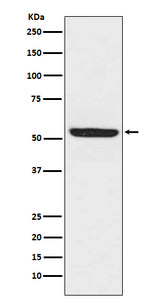 Anti-SPHK1 Monoclonal Antibody Boster Bio