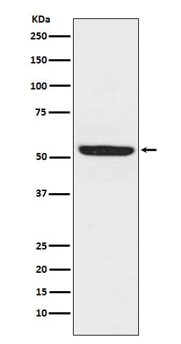 Anti-SPHK1 Monoclonal Antibody Boster Bio