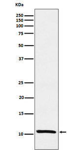 Anti-Estrogen Inducible Protein pS2 Monoclonal Antibody Boster Bio