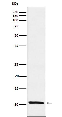 Anti-Estrogen Inducible Protein pS2 Monoclonal Antibody Boster Bio