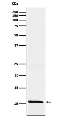 Anti-Estrogen Inducible Protein pS2 Monoclonal Antibody Boster Bio