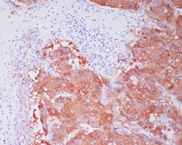 Anti-ALDH1A1 Rabbit Monoclonal Antibody Boster Bio