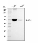 Anti-ALDH1A1 Antibody Picoband® (monoclonal, 4C3 Boster Bio