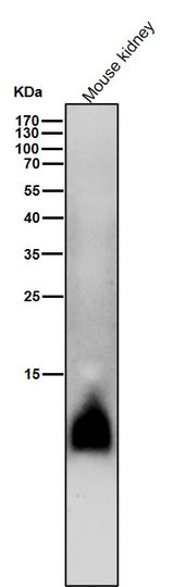 Anti-Phospho-Phospholamban (S16) Rabbit Monoclonal Antibody Boster Bio