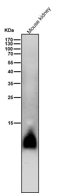 Anti-Phospho-Phospholamban (S16) Rabbit Monoclonal Antibody Boster Bio