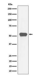 Anti-MEF2A Rabbit Monoclonal Antibody Boster Bio