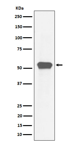 Anti-MEF2A Rabbit Monoclonal Antibody Boster Bio