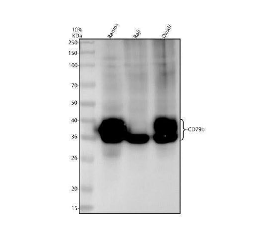 Anti-CD79b Rabbit Monoclonal Antibody Boster Bio