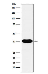 Anti-CD79B Monoclonal Antibody Boster Bio