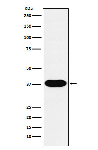 Anti-CD79B Monoclonal Antibody Boster Bio