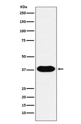 Anti-CD79B Monoclonal Antibody Boster Bio
