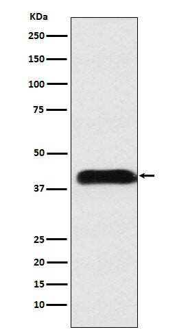 Anti-M6PR Rabbit Monoclonal Antibody Boster Bio